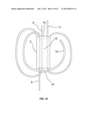 BRAIDED LOOP UTILIZING BIFURCATION TECHNOLOGY diagram and image