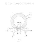 BRAIDED LOOP UTILIZING BIFURCATION TECHNOLOGY diagram and image