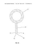 BRAIDED LOOP UTILIZING BIFURCATION TECHNOLOGY diagram and image