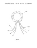 BRAIDED LOOP UTILIZING BIFURCATION TECHNOLOGY diagram and image