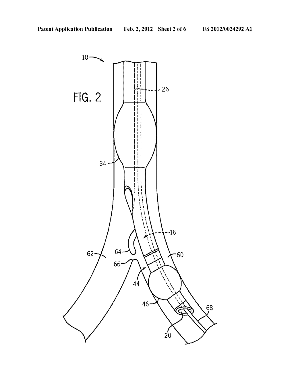 DUAL-LUMEN TRACHEAL TUBE WITH SHAPED LUMEN DIVIDER - diagram, schematic, and image 03