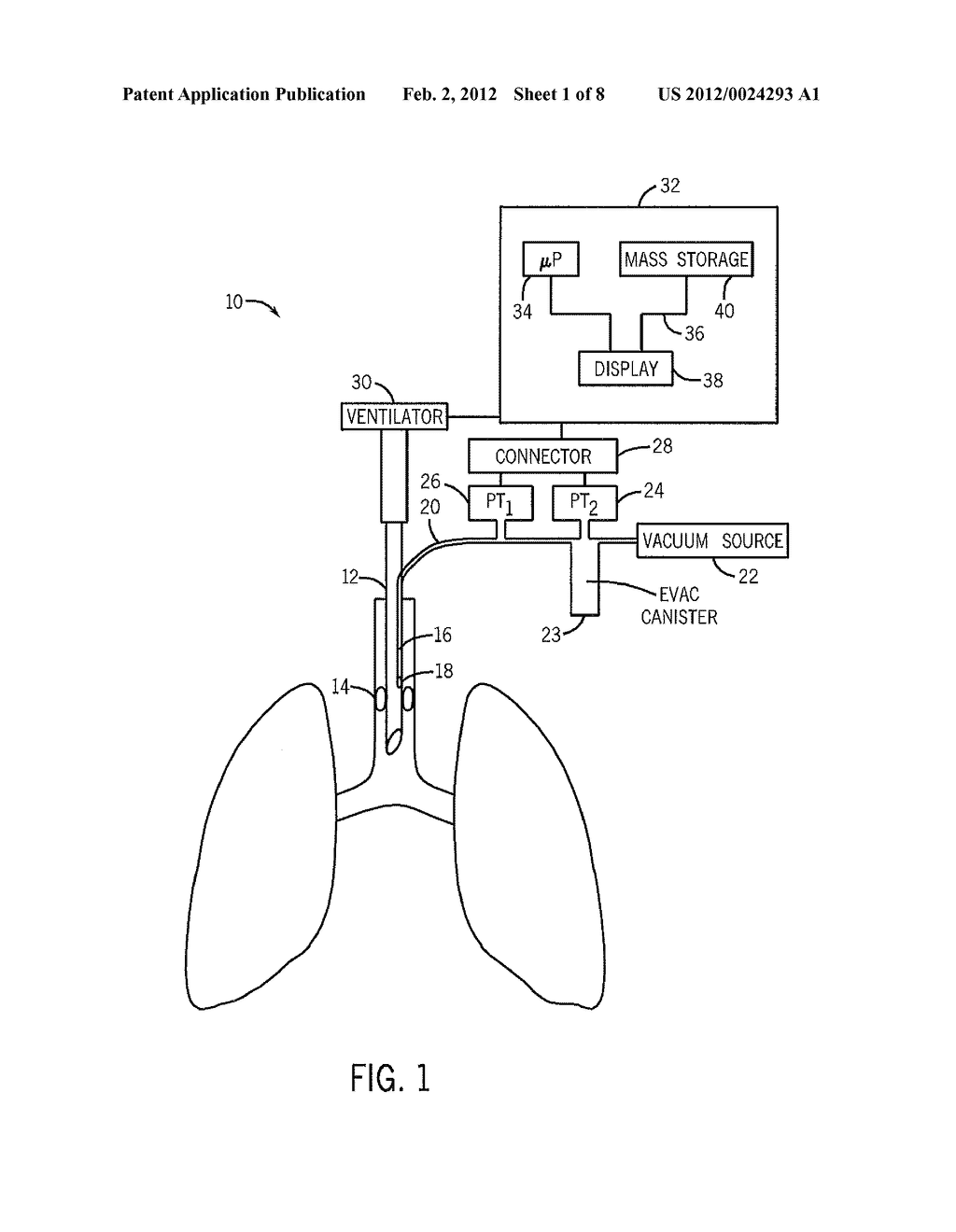 MEDICAL DEVICE TUBE HAVING SUCTION LUMEN AND AN ASSOCIATED SUCTIONING     SYSTEM - diagram, schematic, and image 02