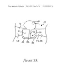 NAIL GUIDE AND METHODOLOGY OF USE diagram and image