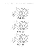 FIBROUS WEB FORMED ON A STRUCTURED FABRIC diagram and image