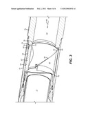 Pressure Vortex Device to Allow Flapper Closure in High Velocity Fluid     Applications diagram and image