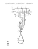 MULTISTAGE CYCLONIC FLUID SEPARATOR diagram and image