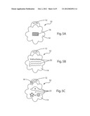 Packaging for an article to be worn diagram and image