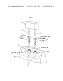 SUPPORTING STRUCTURE OF HEADREST BRACKET diagram and image