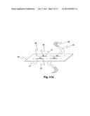 Modular MRI phased array antenna diagram and image