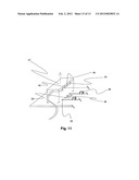 Modular MRI phased array antenna diagram and image