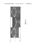 INTRAOPERATIVE IMAGING SYSTEM AND APPARATUS diagram and image