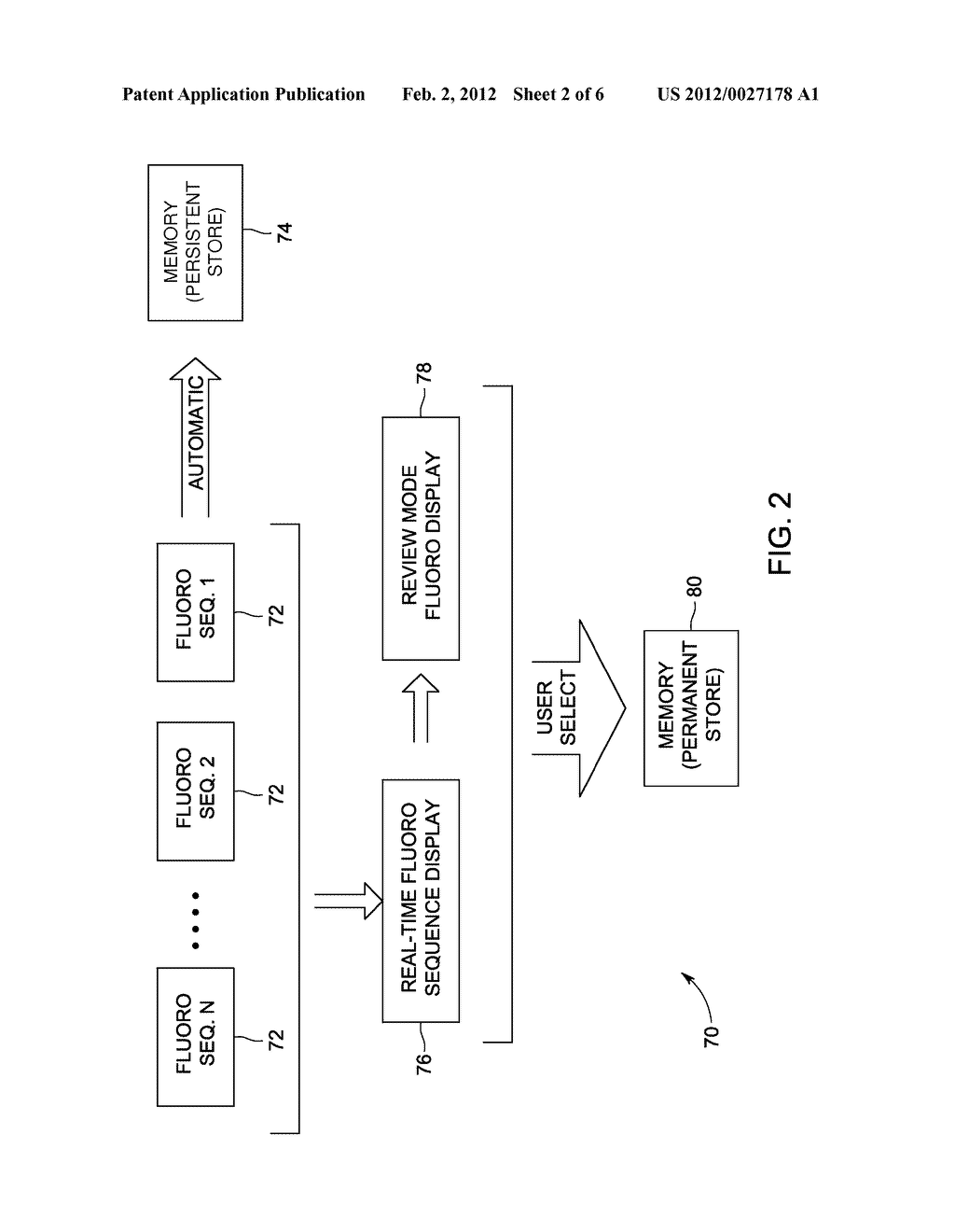 METHODS AND APPARATUS FOR ARCHIVING X-RAY FLUOROSCOPY IMAGES - diagram, schematic, and image 03