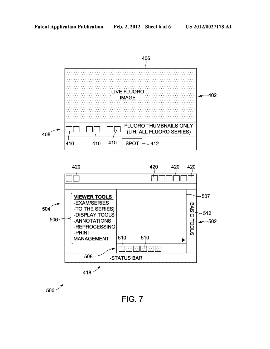 METHODS AND APPARATUS FOR ARCHIVING X-RAY FLUOROSCOPY IMAGES - diagram, schematic, and image 07