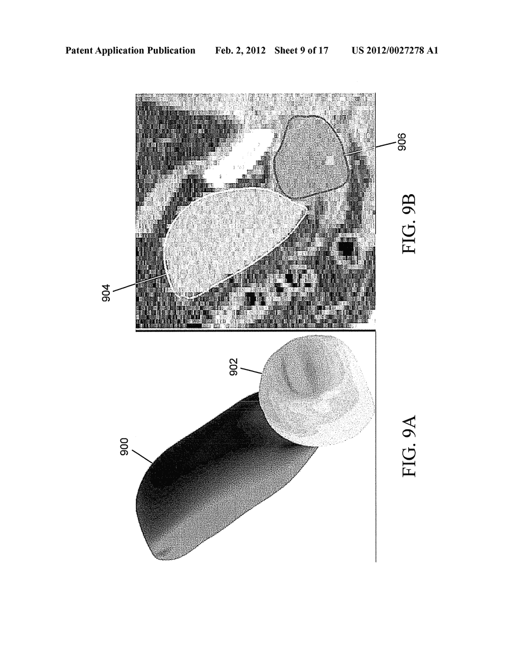 METHODS, SYSTEMS, AND COMPUTER READABLE MEDIA FOR MAPPING REGIONS IN A     MODEL OF AN OBJECT COMPRISING AN ANATOMICAL STRUCTURE FROM ONE IMAGE DATA     SET TO IMAGES USED IN A DIAGNOSTIC OR THERAPEUTIC INTERVENTION - diagram, schematic, and image 10
