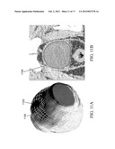 METHODS, SYSTEMS, AND COMPUTER READABLE MEDIA FOR MAPPING REGIONS IN A     MODEL OF AN OBJECT COMPRISING AN ANATOMICAL STRUCTURE FROM ONE IMAGE DATA     SET TO IMAGES USED IN A DIAGNOSTIC OR THERAPEUTIC INTERVENTION diagram and image