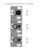 METHODS, SYSTEMS, AND COMPUTER READABLE MEDIA FOR MAPPING REGIONS IN A     MODEL OF AN OBJECT COMPRISING AN ANATOMICAL STRUCTURE FROM ONE IMAGE DATA     SET TO IMAGES USED IN A DIAGNOSTIC OR THERAPEUTIC INTERVENTION diagram and image