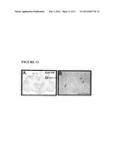 Methods for Distributing High Levels of Therapeutic Agent Throughout the     Cortex to Treat Neurological Disorders diagram and image