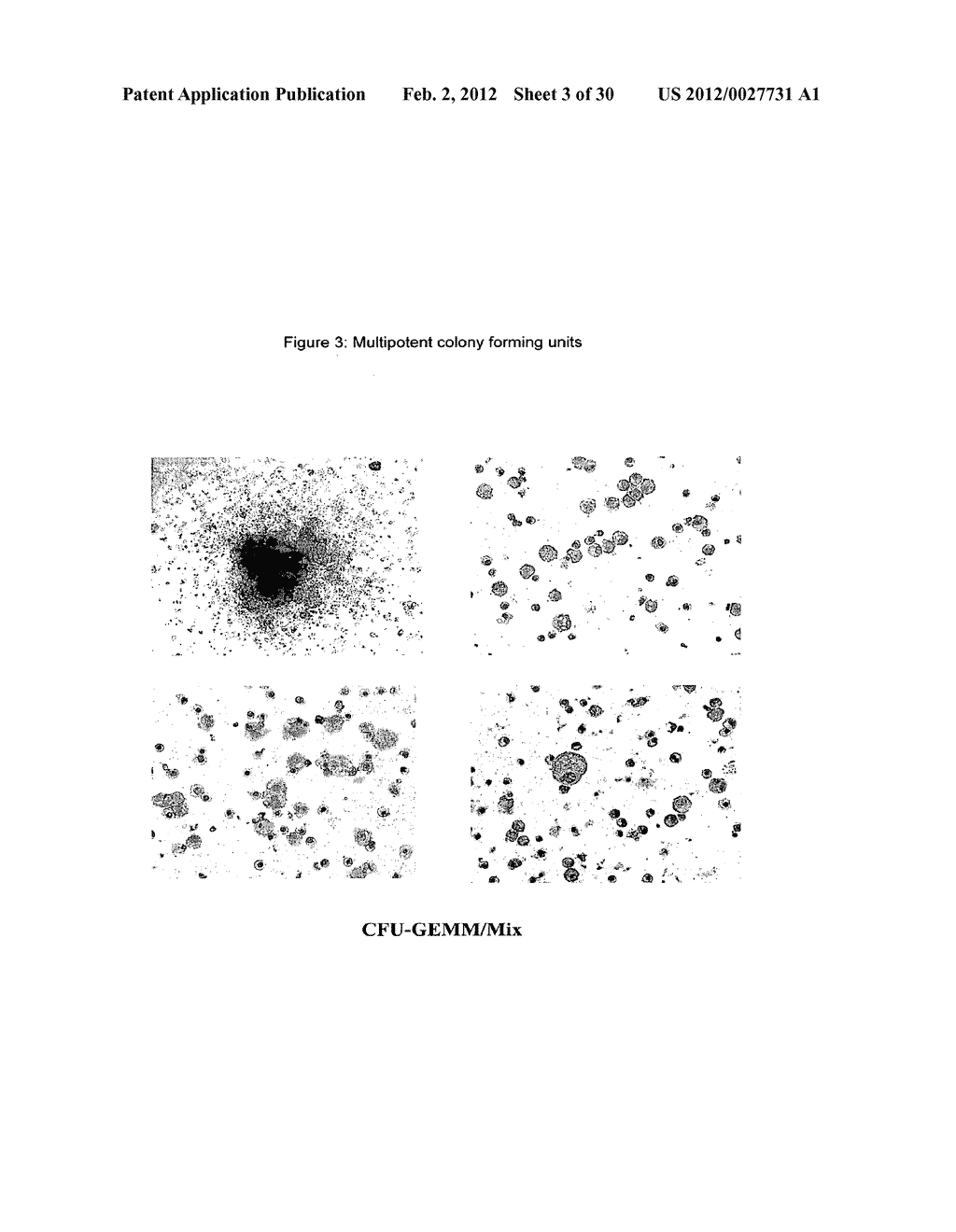 HEMANGIO-COLONY FORMING CELLS - diagram, schematic, and image 04