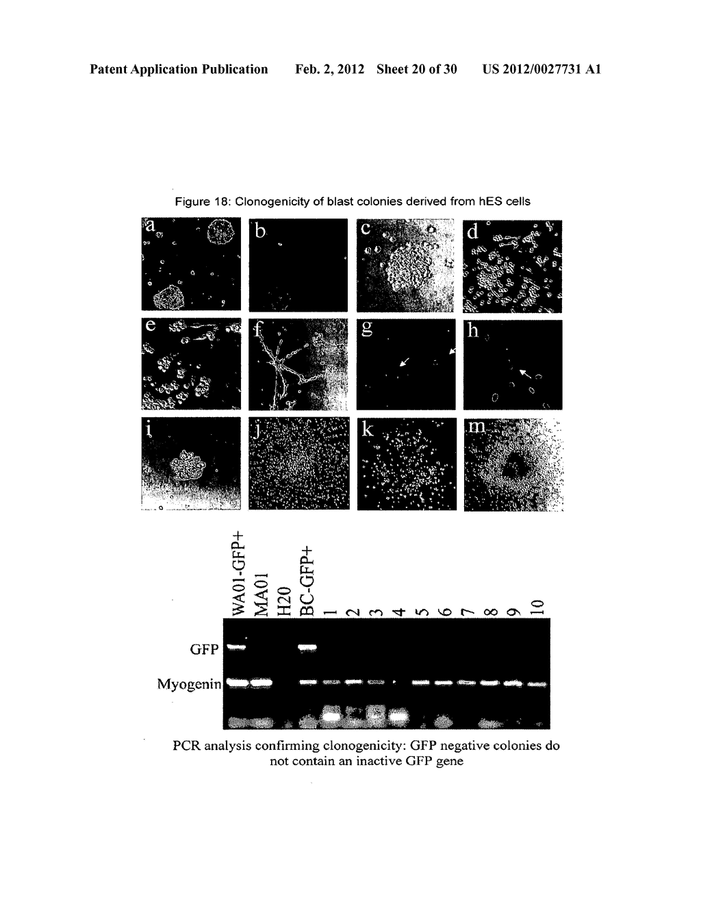 HEMANGIO-COLONY FORMING CELLS - diagram, schematic, and image 21