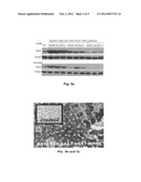 ALANINE-GLYOXYLATE AMINOTRANSFERASE THERAPEUTICS diagram and image