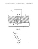 APPARATUS FOR SEALING A PUNCTURE BY CAUSING A REDUCTION IN THE     CIRCUMFERENCE OF THE PUNCTURE diagram and image