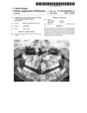 CORRECTION OF ALVEOLAR CLEFT WITH CALCIUM-BASED BONE GRAFT MATERIALS diagram and image