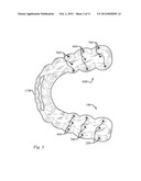 DENTAL ORTHOTIC diagram and image