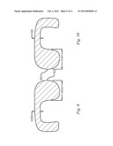 DENTAL ORTHOTIC diagram and image