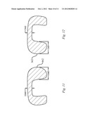 DENTAL ORTHOTIC diagram and image