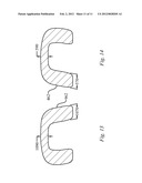 DENTAL ORTHOTIC diagram and image