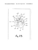 SELF LIGATING BRACKET SYSTEM diagram and image