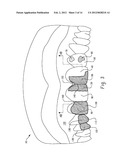 STENTS AND METHOD FOR DENTAL RESTORATION USING SAME diagram and image