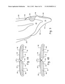 STENTS AND METHOD FOR DENTAL RESTORATION USING SAME diagram and image