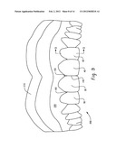 STENTS AND METHOD FOR DENTAL RESTORATION USING SAME diagram and image