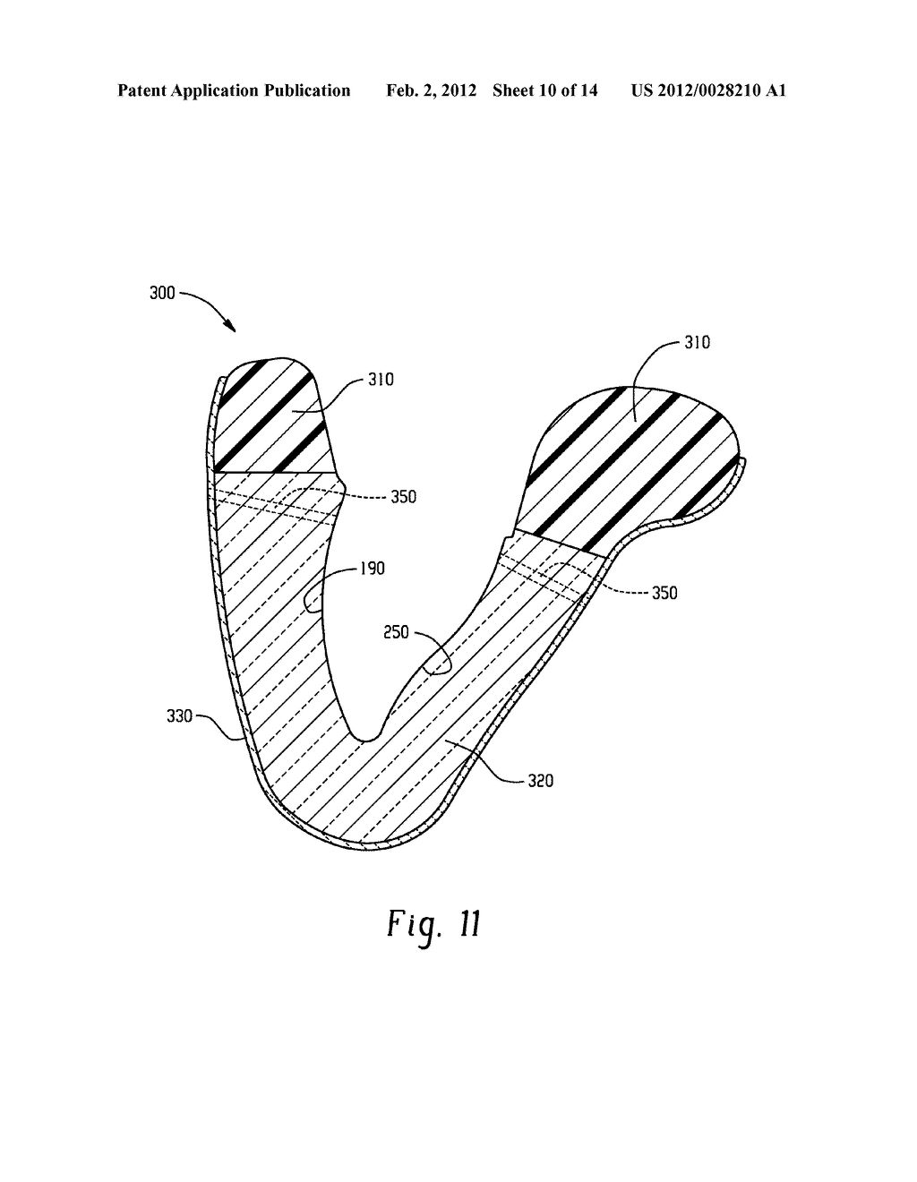 STENTS AND METHOD FOR DENTAL RESTORATION USING SAME - diagram, schematic, and image 11