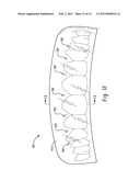 STENTS AND METHOD FOR DENTAL RESTORATION USING SAME diagram and image