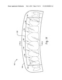 STENTS AND METHOD FOR DENTAL RESTORATION USING SAME diagram and image