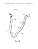 STENTS AND METHOD FOR DENTAL RESTORATION USING SAME diagram and image