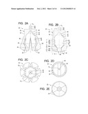 Systems and Methods for Reconditioning Implants in Situ diagram and image