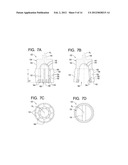 Systems and Methods for Reconditioning Implants in Situ diagram and image