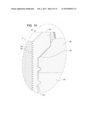 Systems and Methods for Reconditioning Implants in Situ diagram and image