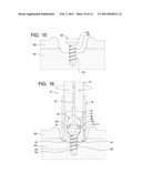 Systems and Methods for Reconditioning Implants in Situ diagram and image