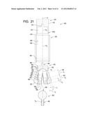 Systems and Methods for Reconditioning Implants in Situ diagram and image