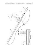 ARROW POINT ALIGNMENT SYSTEM diagram and image