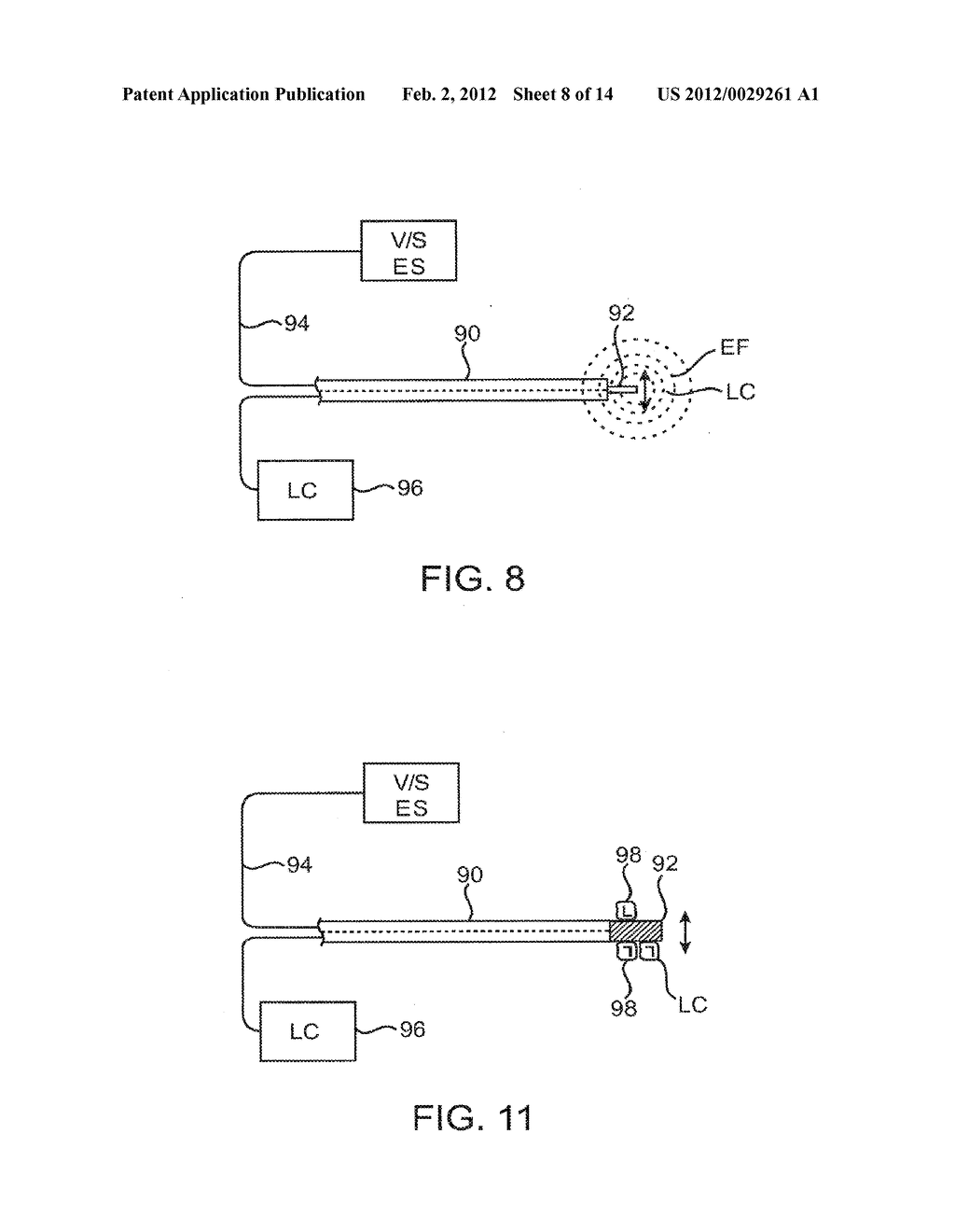 SYSTEMS AND METHODS FOR DELIVERY OF A THERAPEUTIC AGENT - diagram, schematic, and image 09