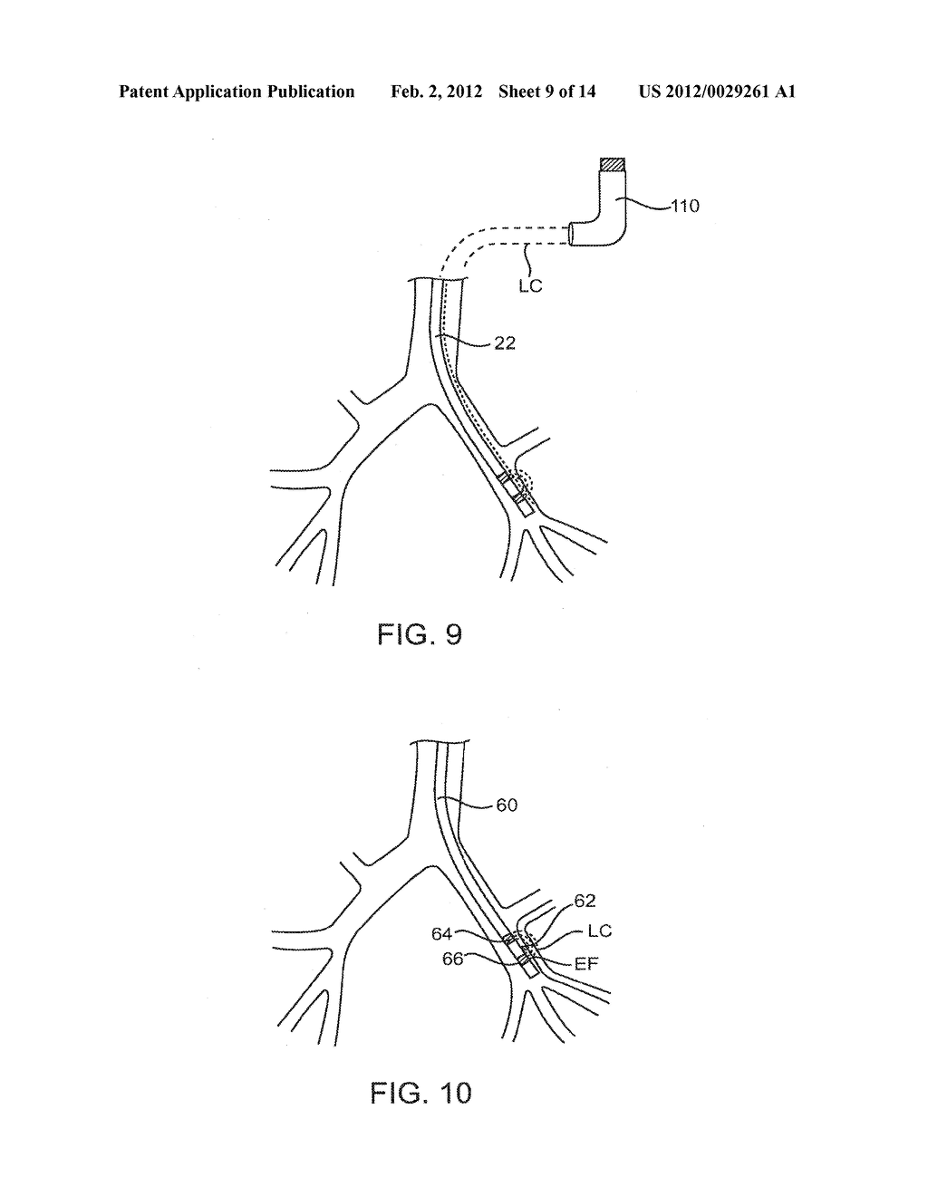 SYSTEMS AND METHODS FOR DELIVERY OF A THERAPEUTIC AGENT - diagram, schematic, and image 10