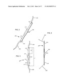 BODILY IMPLANTS AND METHODS OF ADJUSTING THE SAME diagram and image