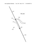 BODILY IMPLANTS AND METHODS OF ADJUSTING THE SAME diagram and image