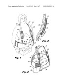 PANNUS SUPPORT ADAPTED FOR SURGICAL PROCEDURES diagram and image