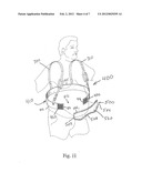 PANNUS SUPPORT ADAPTED FOR SURGICAL PROCEDURES diagram and image